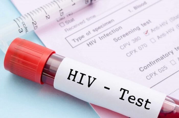 Lý do nên xét nghiệm HIV