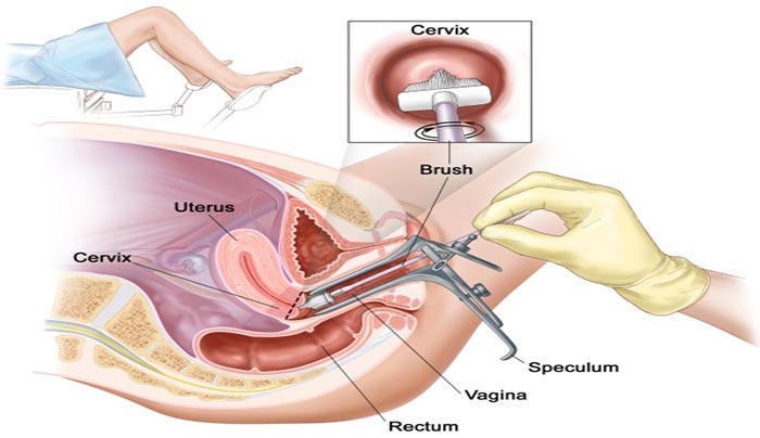 Mổ nội soi tử cung buồng trứng có ảnh hưởng đến kinh nguyệt 